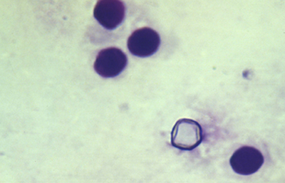 Acanthamoeba Giemsa. Original x200