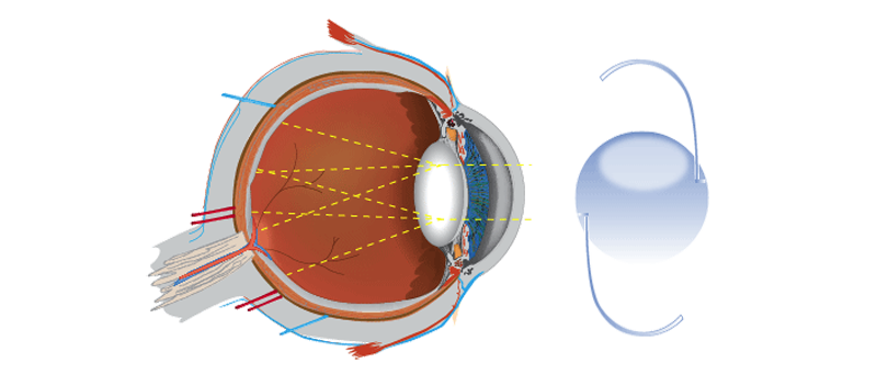 Ojo Sano