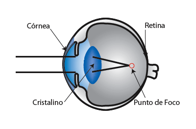 Diagrama Vision Miopía